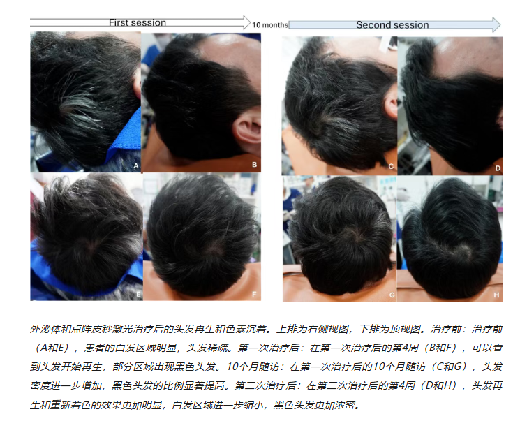 144fded7a0dd095fb240ec6a520b1b66.png 144fded7a0dd095fb240ec6a520b1b66.png