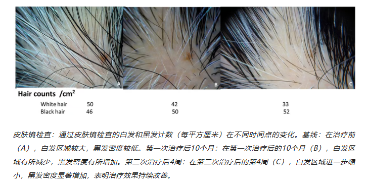 f900b040051d6ff365c9d683fa4fb832.png f900b040051d6ff365c9d683fa4fb832.png